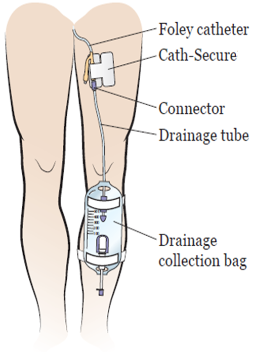 Sterile PVC Disposable Urine Bags , Medical Leg Bag With Inlet Tube For Hospital Clinic