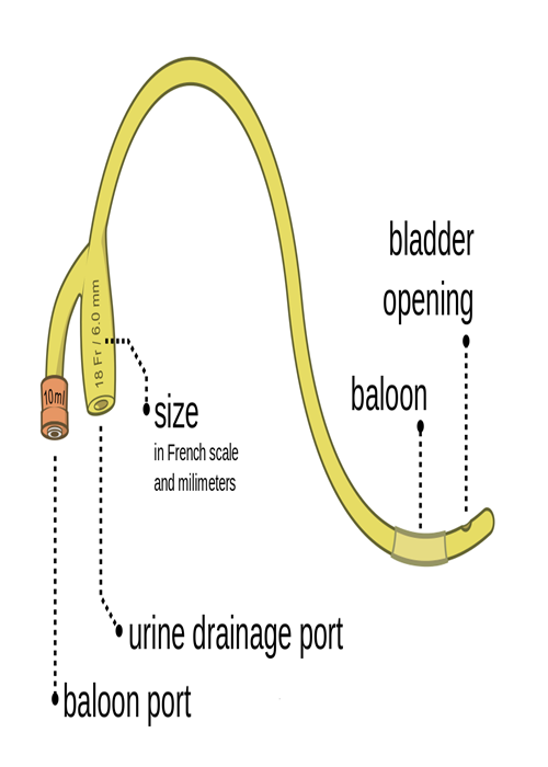 2 Way Latex Disposable Urinary Catheters , Orange Valve Foley Catheter With Balloon