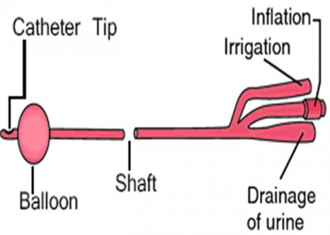 1 / 2 / 3 Way Medical Imported Latex Urethral Catheter Single Use Anti Back Flow