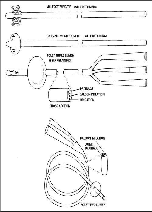 DEHP Free Disposable Urinary Catheters , 3 Way Foley Urinary Catheter Red Plastic Valve