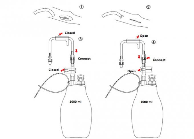 Individual Packing Closed Wound Drainage System PVC Vacuum High Hardness