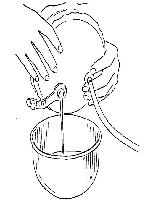 Anti - Leakage 800ml Disposable Abdominal Drainage Tube With 3 Activated Springs