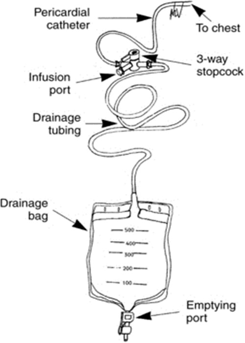 Sterile Medical Single Use Wound Drainage System , PVC Wound Drainage Bag With Outlet